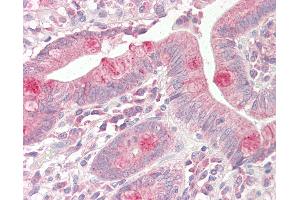 Anti-VAMP7 / SYBL1 / T1 VAMP antibody IHC staining of human small intestine.