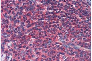 Human Tonsil (formalin-fixed, paraffin-embedded) stained with NPY1R antibody ABIN462232 followed by biotinylated goat anti-rabbit IgG secondary antibody ABIN481713, alkaline phosphatase-streptavidin and chromogen.