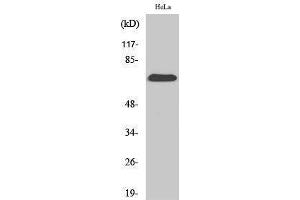 Western Blotting (WB) image for anti-Succinate Dehydrogenase Complex, Subunit A, Flavoprotein (Fp) (SDHA) (C-Term) antibody (ABIN3186888) (SDHA anticorps  (C-Term))