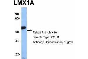 Host: Rabbit  Target Name: TRIM10  Sample Tissue: 721_B  Antibody Dilution: 1. (LMX1A anticorps  (Middle Region))