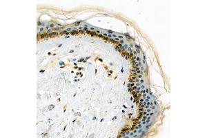 Immunohistochemistry of paraffin embedded human skin using GDPD2 (ABIN7074098) at dilution of 1:650 (400x lens)