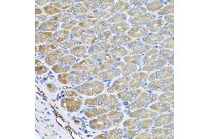 Immunohistochemistry of paraffin-embedded mouse stomach using VPS37A antibody. (VPS37A anticorps)