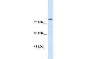 WB Suggested Anti-ACTN4  Antibody Titration: 0. (alpha Actinin 4 anticorps  (C-Term))