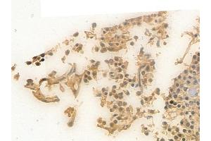 ABIN6256550 and ABIN6267640 at 1/100 staining human pituitary adenoma by IHC-P.