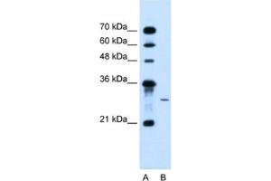 Western Blotting (WB) image for anti-1-Acylglycerol-3-Phosphate O-Acyltransferase 2 (Lysophosphatidic Acid Acyltransferase, Beta) (AGPAT2) antibody (ABIN2463969) (AGPAT2 anticorps)