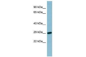 RBP4 antibody used at 1 ug/ml to detect target protein. (RBP4 anticorps  (N-Term))