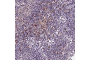 Immunohistochemical staining (Formalin-fixed paraffin-embedded sections) of human lymph node with CD1E polyclonal antibody  shows moderate cytoplasmic positivity in subset of non-germinal center cells. (CD1e anticorps  (AA 79-147))