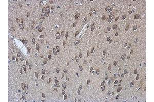 Image no. 1 for anti-Poly(A) Binding Protein, Cytoplasmic 4 (Inducible Form) (PABPC4) (AA 18-229) antibody (ABIN1500006)