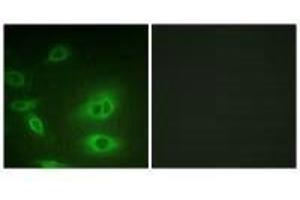 Immunofluorescence analysis of HeLa cells, using ATP1α1/Na+K+ ATPase1 (Ab-23) antibody. (ATP1A1 anticorps  (Ser23))