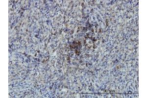 Immunoperoxidase of monoclonal antibody to SWAP70 on formalin-fixed paraffin-embedded human spleen.