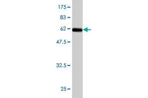 Western Blot detection against Immunogen (61.