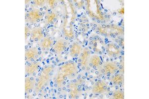 Immunohistochemistry of paraffin-embedded mouse kidney using CYP4A11 antibody at dilution of 1:100 (40x lens). (CYP4A11 anticorps)