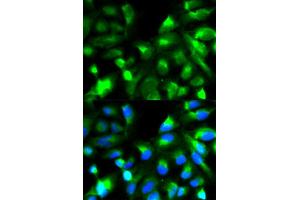 Immunofluorescence analysis of HeLa cell using SNAP25 antibody. (SNAP25 anticorps)