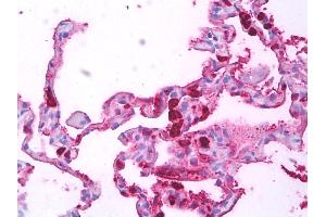 Anti-Macrophages antibody IHC of human lung, macrophages. (Macrophages anticorps)