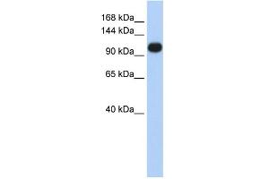 WB Suggested Anti-ATP2A3 Antibody Titration:  0. (ATP2A3 anticorps  (Middle Region))