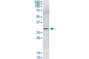 HOXB9 MaxPab rabbit polyclonal antibody.