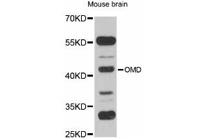 Western blot analysis of extracts of mouse brain, using OMD antibody (ABIN6290709) at 1:1000 dilution. (Osteomodulin anticorps)