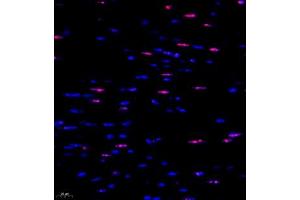Immunofluorescent analysis of paraffin embedded mouse heart using ubp43 (ABIN7076108) at dilution of 1: 1000 (USP18 anticorps)