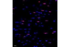 Immunofluorescent analysis of paraffin embedded mouse heart using ubp43 (ABIN7076108) at dilution of 1: 1000 (USP18 anticorps)