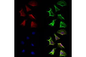 ABIN6264546 and ABIN6272948 staining Hela cells by IF/ICC. (QSOX1 anticorps  (Internal Region))