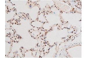 ABIN6267601 at 1/200 staining Rat lung tissue sections by IHC-P. (NF-kB p65 anticorps  (pThr435))