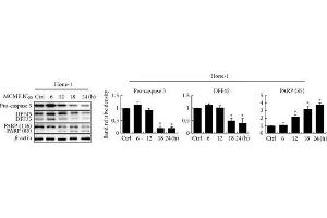 Expression of apoptogenic proteins in MCME-treated cancer cells.