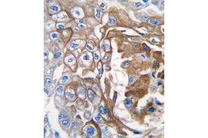Immunohistochemistry (IHC) image for anti-GTPase NRas (NRAS) antibody (ABIN3003468) (GTPase NRas anticorps)