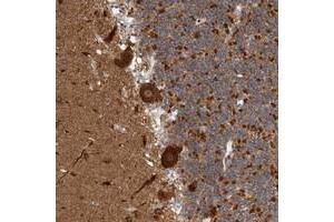 Immunohistochemical staining of human cerebellum with MSL1 polyclonal antibody  shows strong cytoplasmic positivity in Purkinje cells. (MSL1 anticorps)