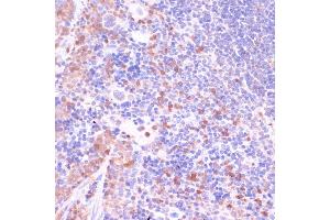 Immunohistochemistry of paraffin-embedded mouse spleen using UGT2B15 antibody (ABIN7271194) at dilution of 1:100 (40x lens). (UGT2B15 anticorps  (AA 60-190))