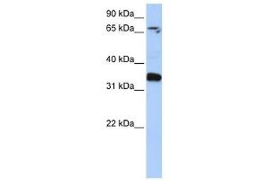 GLE1 antibody used at 1 ug/ml to detect target protein. (GLE1 anticorps)