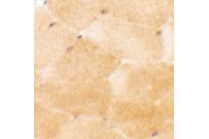 Immunohistochemical anyalysis of mouse skeletal muscle tissue with PRC1 polyclonal antibody  at 2. (PRC1 anticorps  (Internal Region))