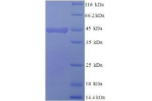 SDS-PAGE (SDS) image for CD68 Molecule (CD68) (AA 21-291), (Extracellular) protein (His-SUMO Tag) (ABIN5709241)