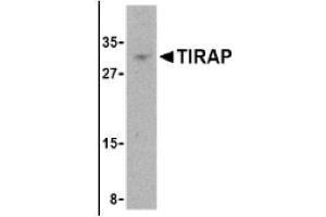 Image no. 1 for anti-Toll-Interleukin 1 Receptor (TIR) Domain Containing Adaptor Protein (TIRAP) (Middle Region) antibody (ABIN265135) (TIRAP anticorps  (Middle Region))
