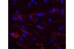 Immunofluorescence analysis of Mouse heart tissue using CD1A Monoclonal Antibody at dilution of 1:200.
