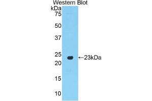 Western blot analysis of the recombinant protein. (PPARG anticorps  (AA 311-493))