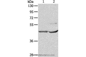 Western blot analysis of Mouse kidney and heart tissue, using NCEH1 Polyclonal Antibody at dilution of 1:1350 (NCEH1 anticorps)