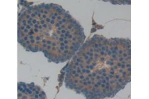 IHC-P analysis of Rat Tissue, with DAB staining. (CD46 anticorps  (AA 136-341))