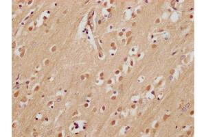 IHC image of ABIN7165518 diluted at 1:200 and staining in paraffin-embedded human brain tissue performed on a Leica BondTM system. (Fam53a anticorps  (AA 135-398))