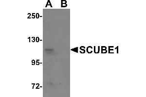 Western Blotting (WB) image for anti-Signal Peptide, CUB Domain, EGF-Like 1 (SCUBE1) (Middle Region) antibody (ABIN1031082) (SCUBE1 anticorps  (Middle Region))