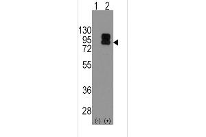 Western blot analysis of CD19 using rabbit polyclonal CD19 Antibody using 293 cell lysates (2 ug/lane) either nontransfected (Lane 1) or transiently transfected with the CD19 gene (Lane 2).