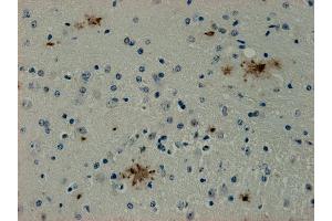 Immunohistochemistry (IHC) image for anti-Syndecan Binding Protein (Syntenin) (SDCBP) antibody (ABIN1742301) (SDCBP anticorps)