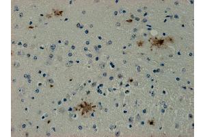 Immunohistochemistry (IHC) image for anti-Syndecan Binding Protein (Syntenin) (SDCBP) antibody (ABIN1742301)