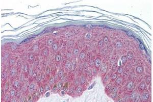 Human Skin: Formalin-Fixed, Paraffin-Embedded (FFPE)