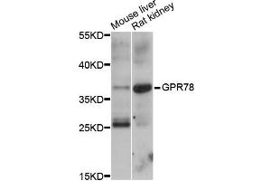 Western blot analysis of extracts of various cell lines, using GPR78 antibody (ABIN6292098) at 1:1000 dilution.