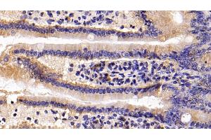 Detection of S100A8 in Mouse Small intestine Tissue using Polyclonal Antibody to S100 Calcium Binding Protein A8 (S100A8)