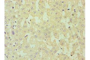 Immunohistochemistry of paraffin-embedded human liver tissue using ABIN7149890 at dilution of 1:100 (DKK4 anticorps  (AA 19-224))