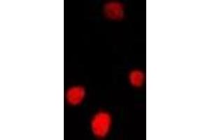 Immunofluorescent analysis of FGF14 staining in U2OS cells. (FGF14 anticorps)
