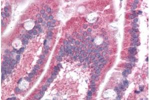 Human Small Intestine: Formalin-Fixed, Paraffin-Embedded (FFPE)