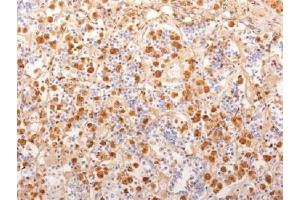 IHC testing of FFPE human pituitary gland with ACTH antibody (ACTH anticorps  (AA 1-24))
