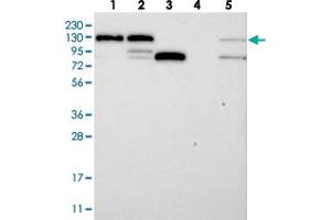 Western blot analysis of Lane 1: RT-4, Lane 2: U-251 MG, Lane 3: Human Plasma, Lane 4: Liver, Lane 5: Tonsil with DDX46 polyclonal antibody . (DDX46 anticorps)